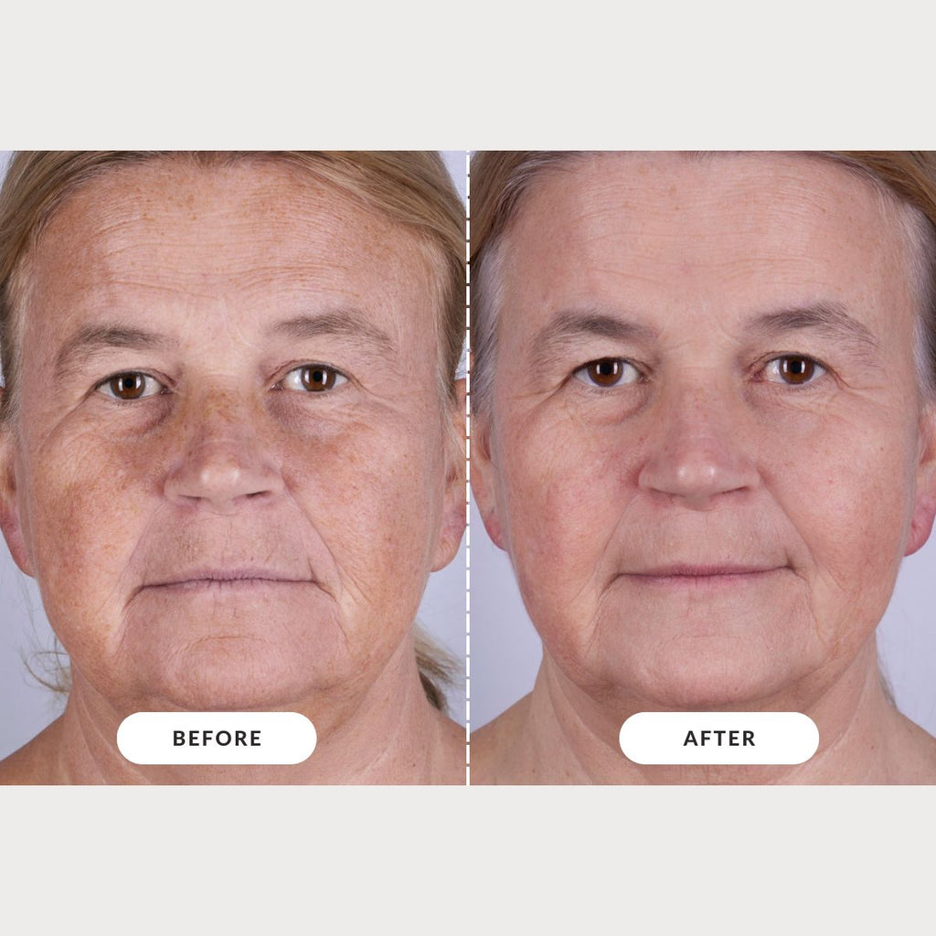 CurrentBody Skin LED Series 2 Face & Neck Kit - Black Friday Offer