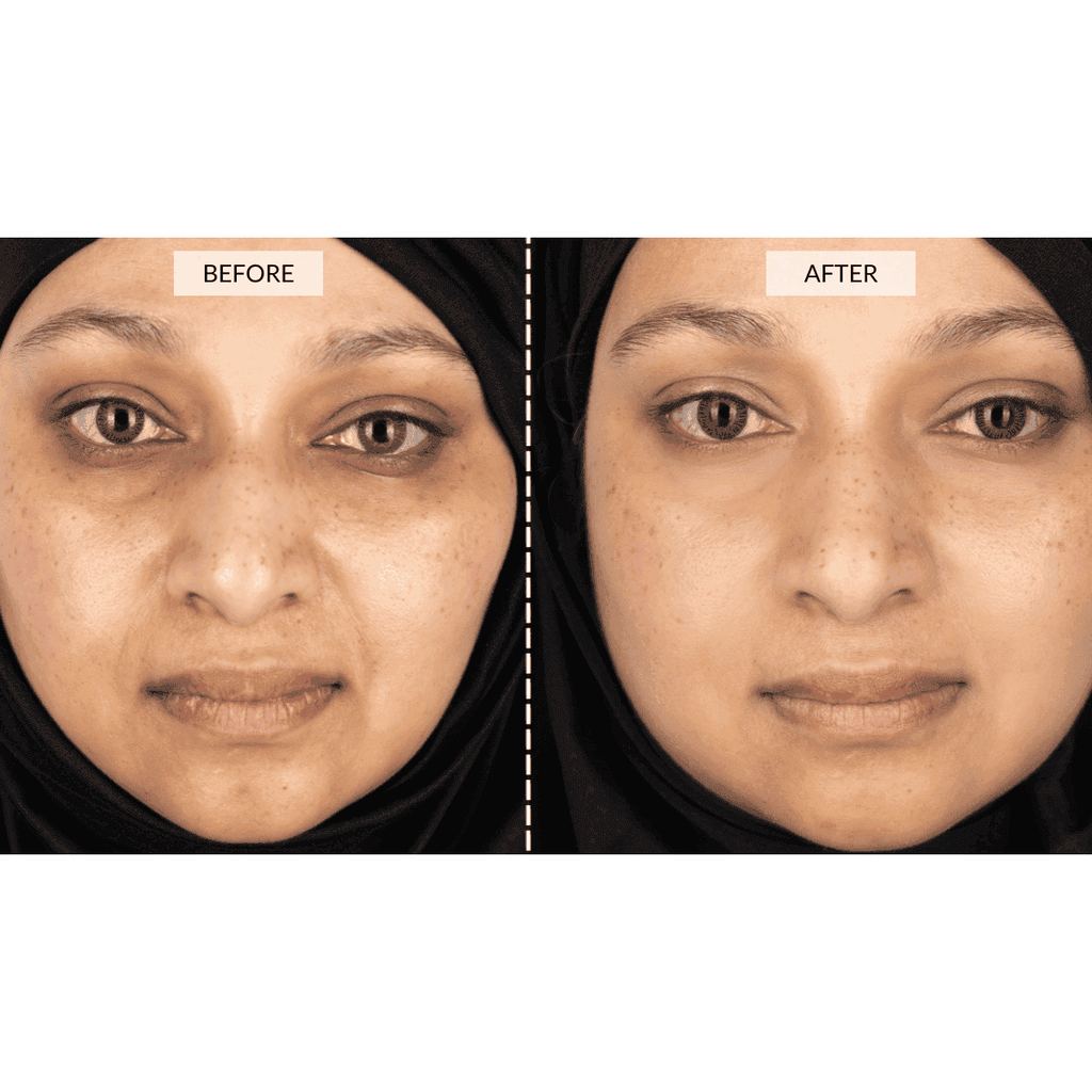 CurrentBody Skin LED 4-in-1 Face & Neck Kit (Worth $889)